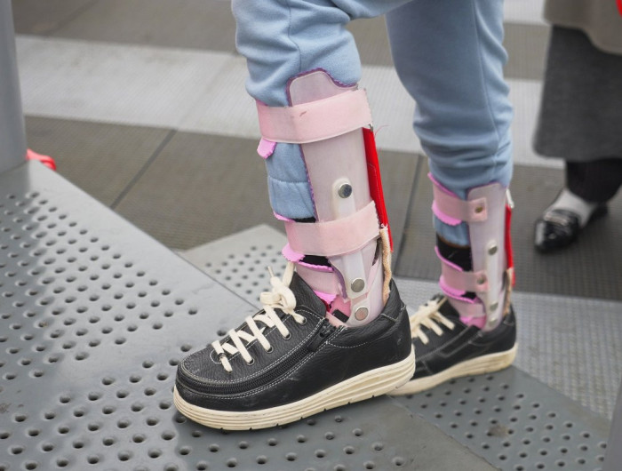 Cik pieejami ir tehniskie palīglīdzekļi bērniem ar kustību traucējumiem?
